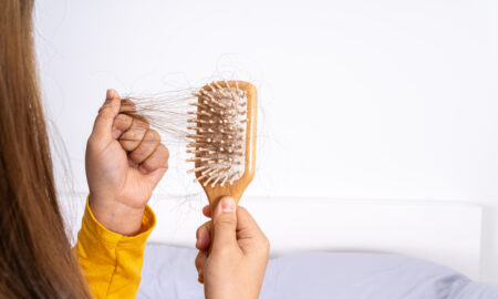 Nasce cabelo até onde não tem, cresce rápido e para de cair