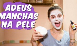 Poderosa receita caseira para tirar manchas da pele