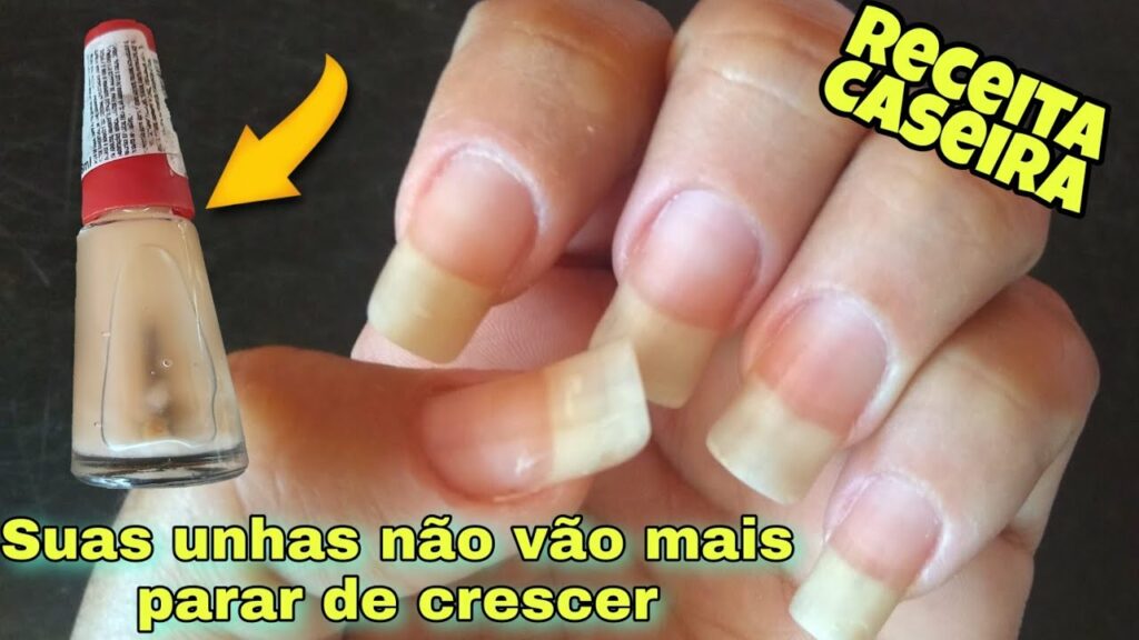 Tenha UNHAS GRANDES e FORTES com essa Receita Caseira