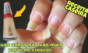 Tenha UNHAS GRANDES e FORTES com essa Receita Caseira