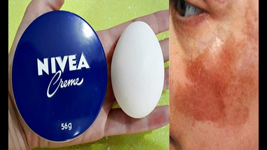 Como Usar Nivea e Clara de Ovo para Parecer 10 Anos Mais Jovem