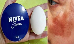 Como Usar Nivea e Clara de Ovo para Parecer 10 Anos Mais Jovem