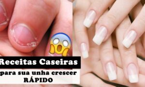 Receitas Caseiras para Estimular o Crescimento Rápido das Unhas