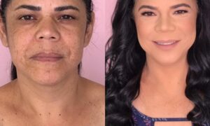 Como Camuflar Melasma do Rosto com Maquiagem