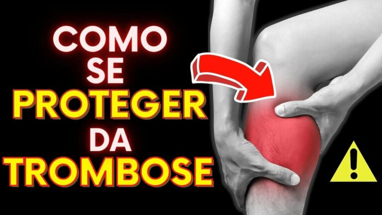 Como Prevenir a Trombose nas Pernas | 7 Alimentos que Melhoram a Circulação Sanguínea