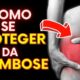 Como Prevenir a Trombose nas Pernas | 7 Alimentos que Melhoram a Circulação Sanguínea