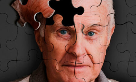 10 Dicas para se Prevenir de Demência e Alzheimer