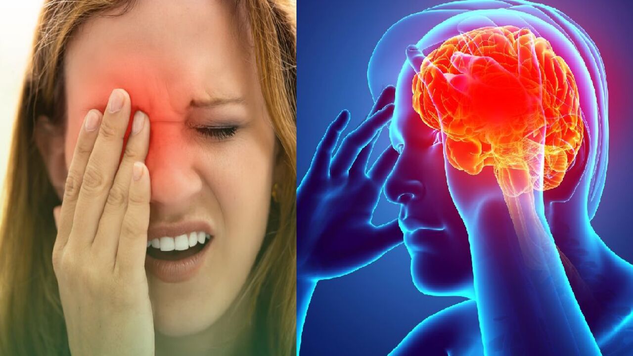 11 sintomas que indicam que você pode ter um aneurisma cerebral; fique atento